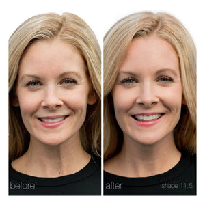 RMS Beauty - UnCoverup Concealer - 5,67 g | 11,5